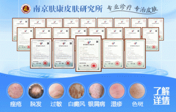 南京皮研所激光美容科挂号详解